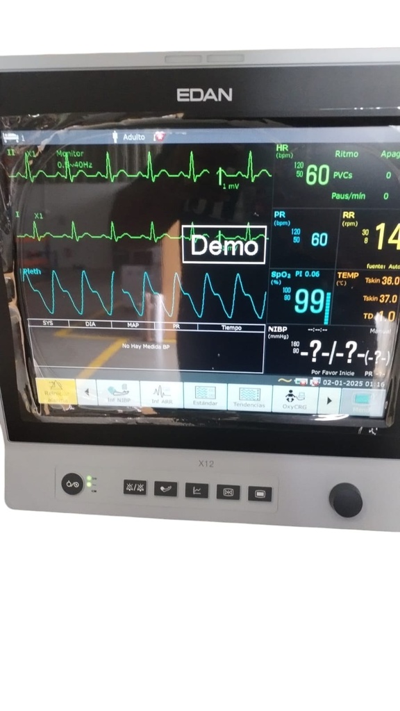 MONITOR DE SIGNOS VITALES
